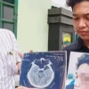 Anggota Taruna Akmil Aniaya Mahasiswa, Dilaporkan ke Polisi dan Denpom Medan